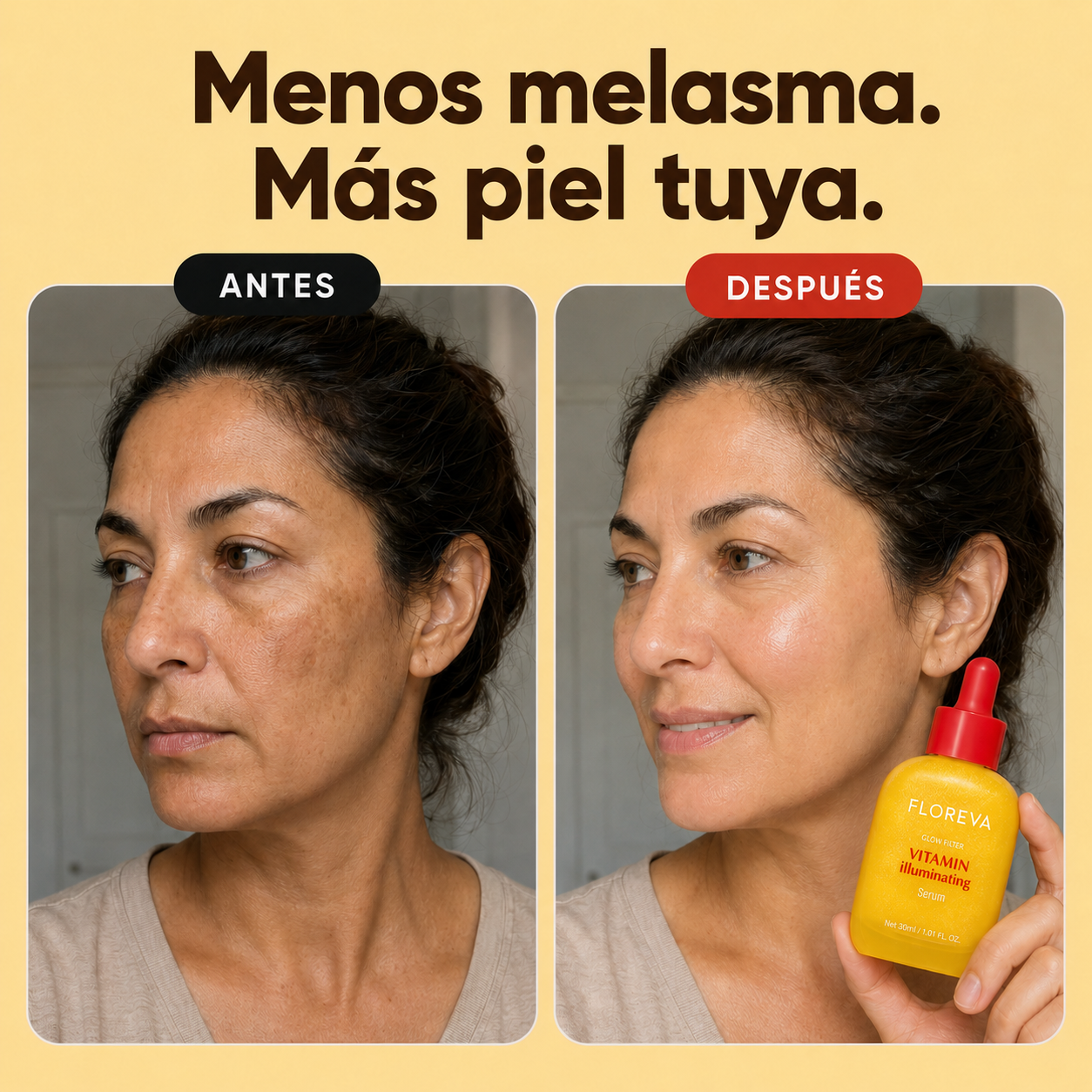 Floreva -  Duo Iluminador | Aclara Manchas Sin Arder