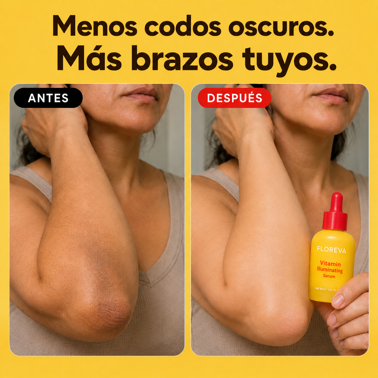Floreva  -  Duo Iluminador | Aclara Manchas Sin Arder.